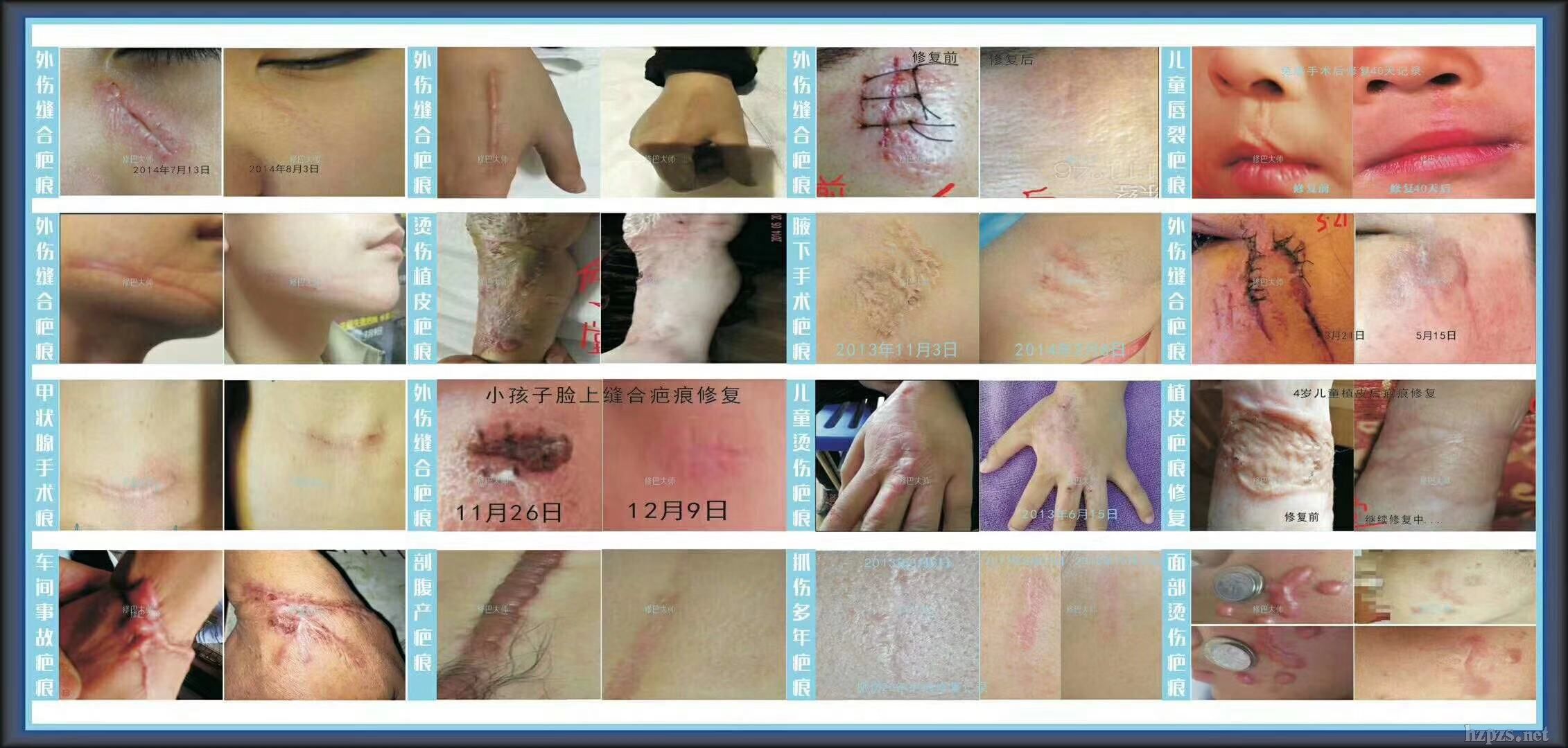 ȥ��-�ް̮a(ch��n)Ʒ-Ч�������M(f��i)�w�(y��n)�ްʹ�